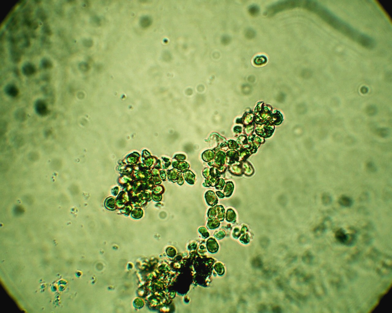 Poltiglia verde: Desmococcus olivaceus